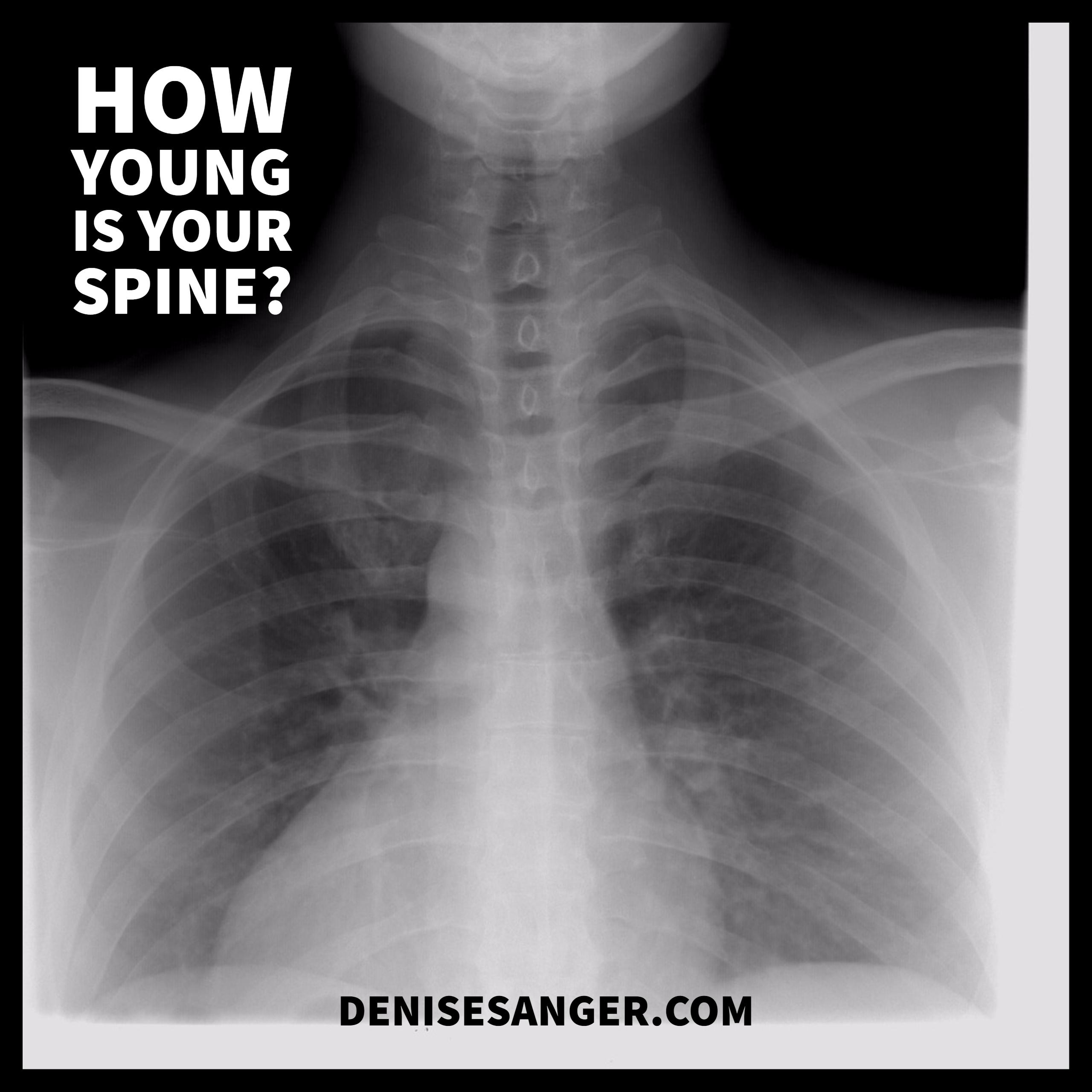 Healthy Living: You Are As Young As Your Spine